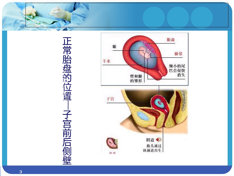 妇产科小讲课课件.ppt_第3页