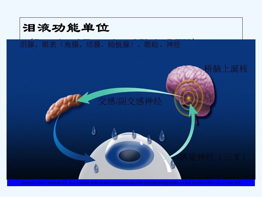 干眼诊断治疗的新进展课件.ppt_第3页