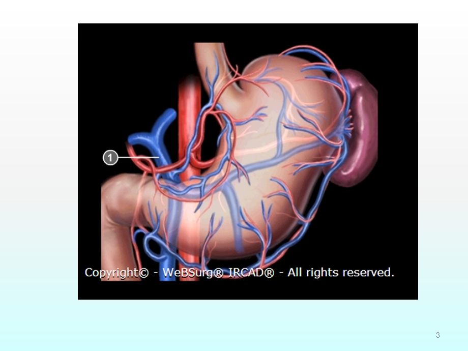 腹腔镜下胃周血管的解剖课件.ppt_第3页