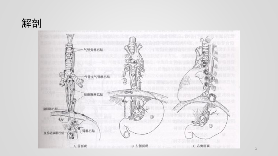 食管癌课件.pptx_第3页