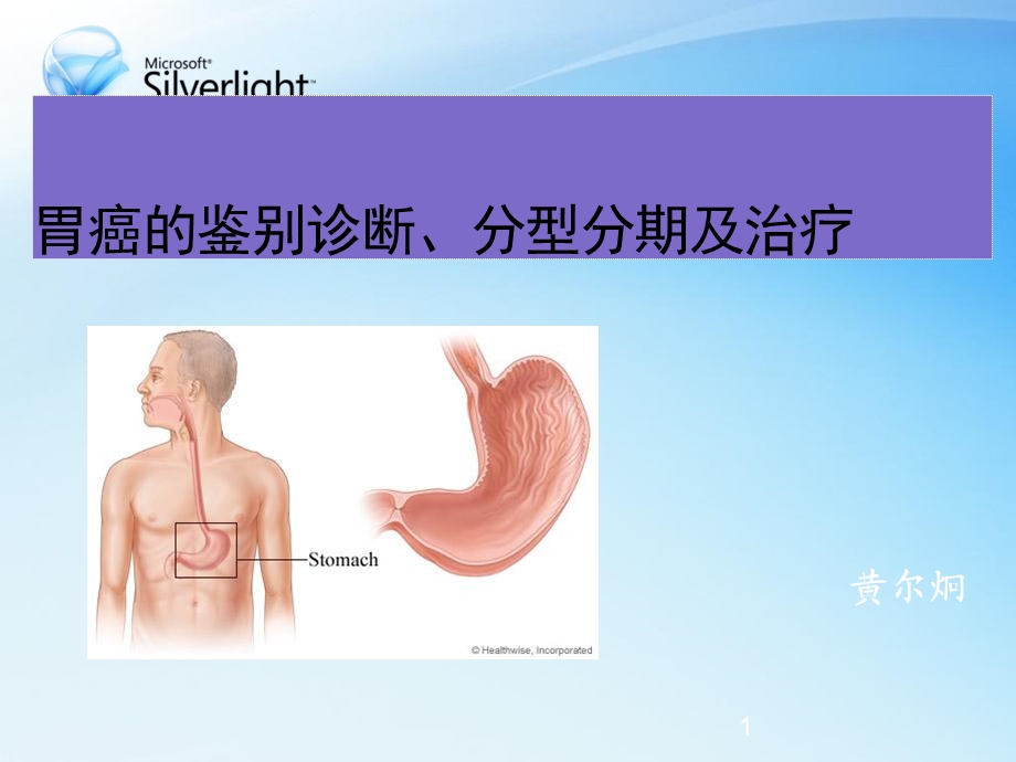 胃癌的鉴别诊断、分型分期及治疗课件.ppt_第1页