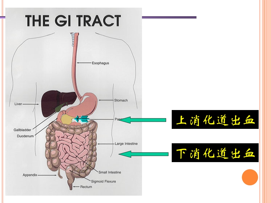 内科护理学课程ppt课件上消化道大量出血.ppt_第2页