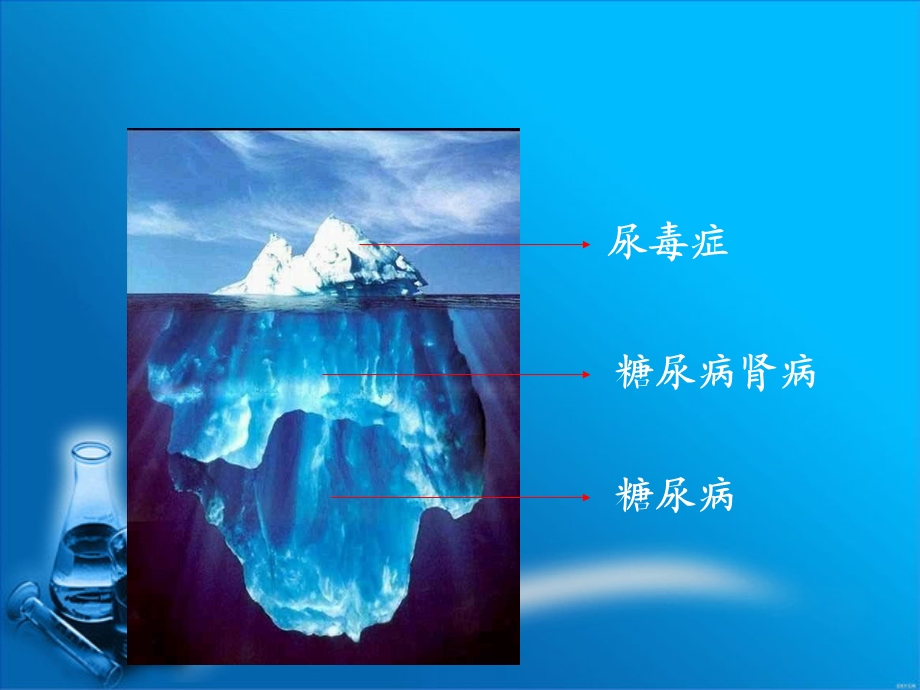 糖尿病肾病小讲课课件.ppt_第3页