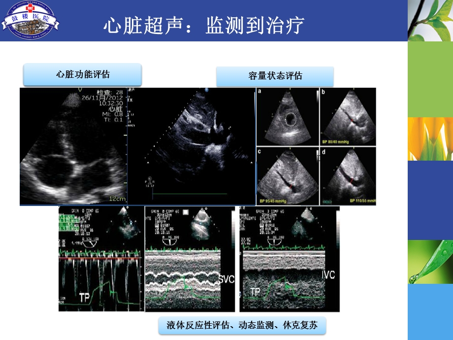 肾脏超声导向的早期诊断课件.ppt_第2页