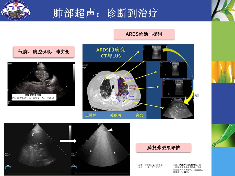 肾脏超声导向的早期诊断课件.ppt_第3页