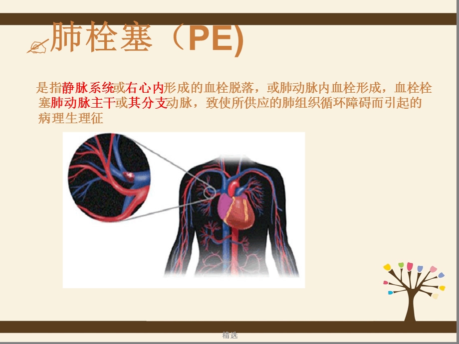 肺栓塞完整最新课件.ppt_第3页