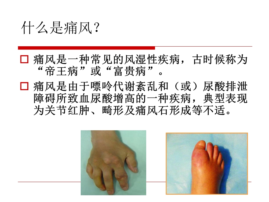 痛风性关节炎的规范化治疗课件.ppt_第2页