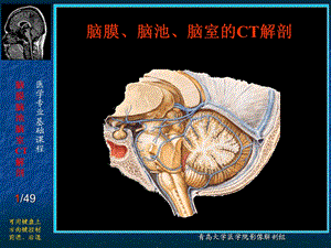 脑膜、脑池、脑室CT解剖.ppt.ppt
