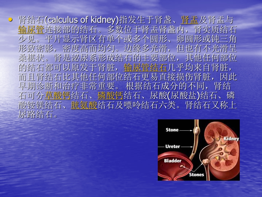 肾结石.ppt1.ppt_第3页