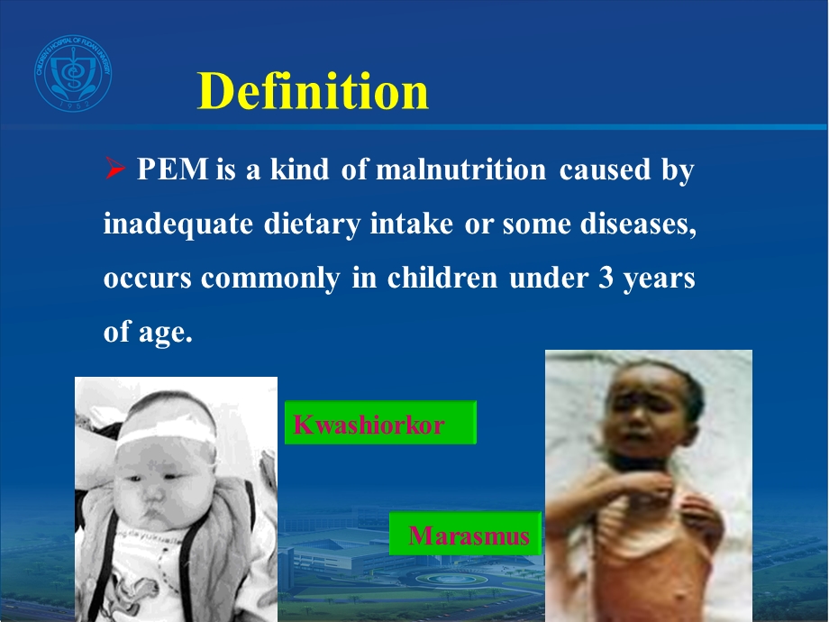 儿童营养性疾病-2006.ppt_第3页
