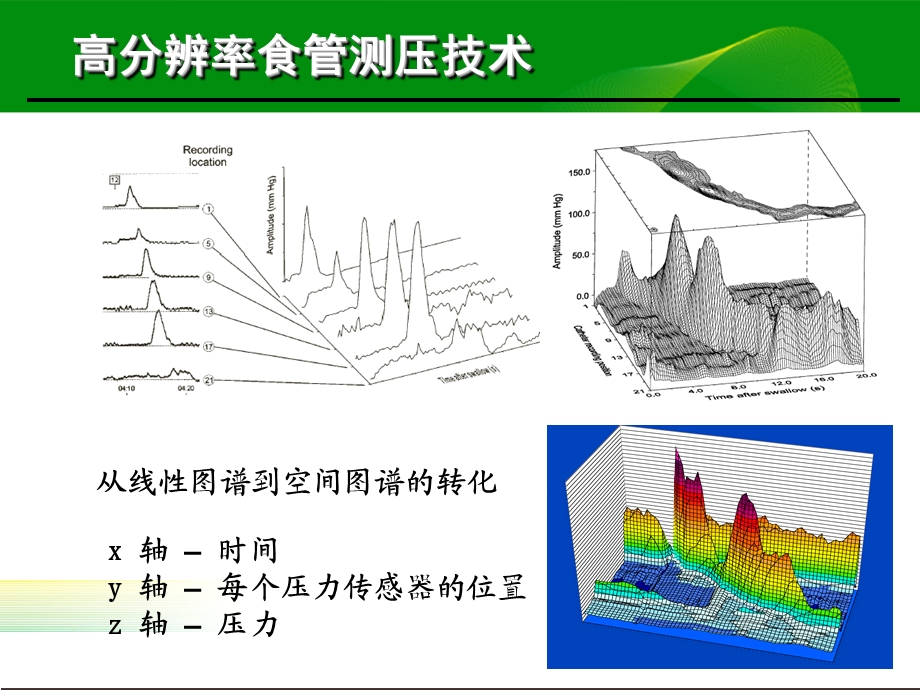 高分辨率食管测压检测技术的临床应用.ppt_第2页