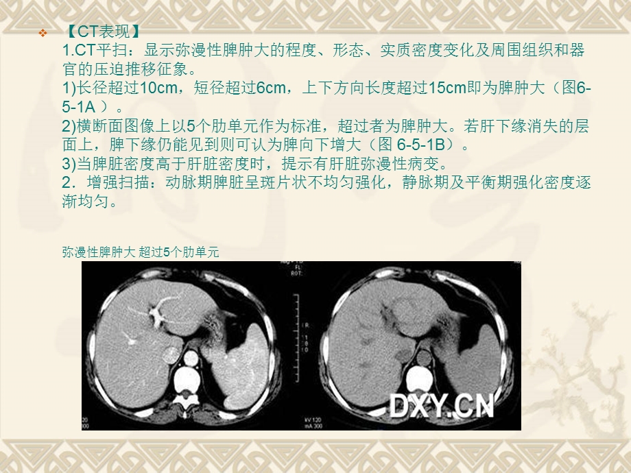 脾脏的正常与异常CT表现.ppt.ppt_第3页