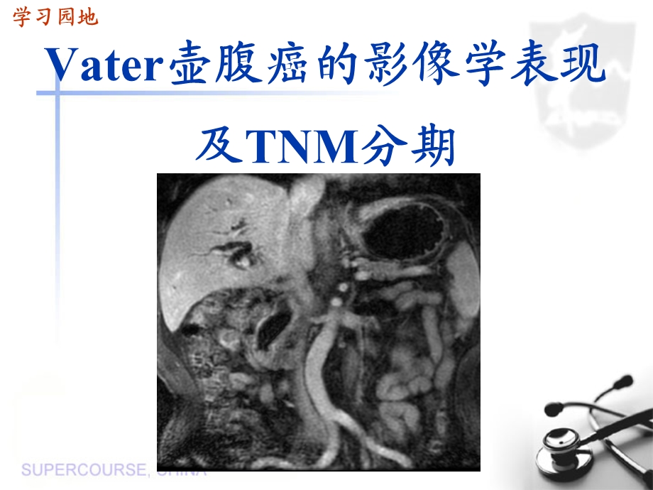 Vater壶腹癌的影像学表现及TNM分期.ppt_第1页