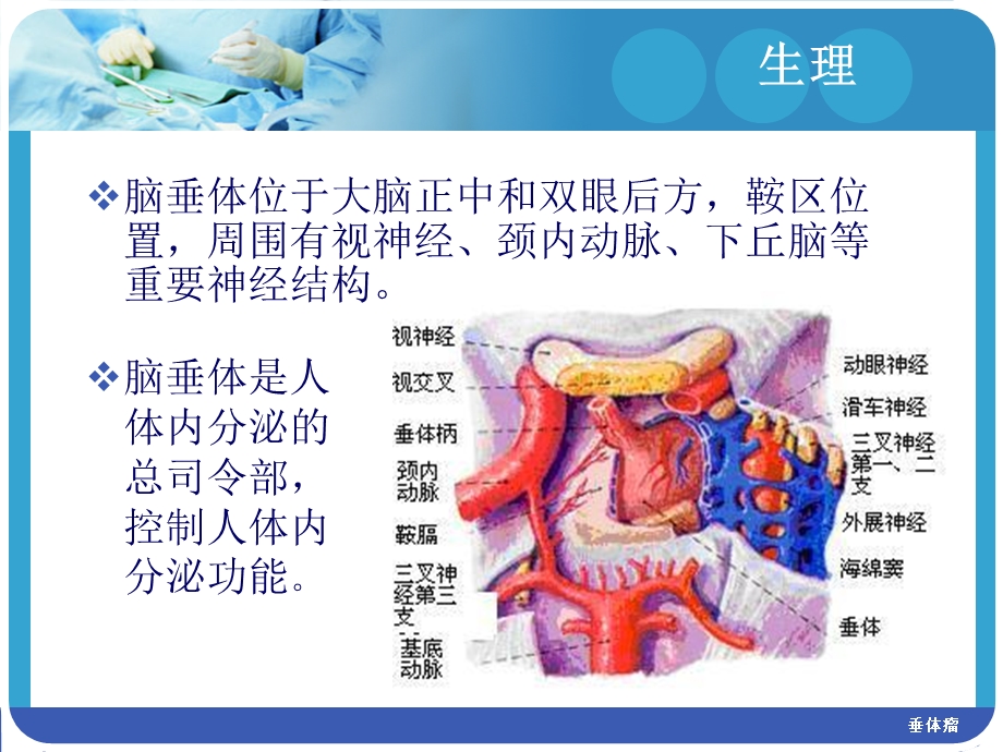 垂体瘤护理查房【精品PPT】 .ppt_第2页