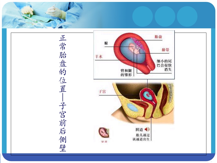 妇产科小讲课培训ppt课件.ppt_第3页