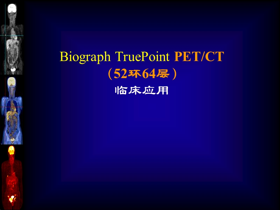 徐慧琴PETCT临床应用.ppt_第1页