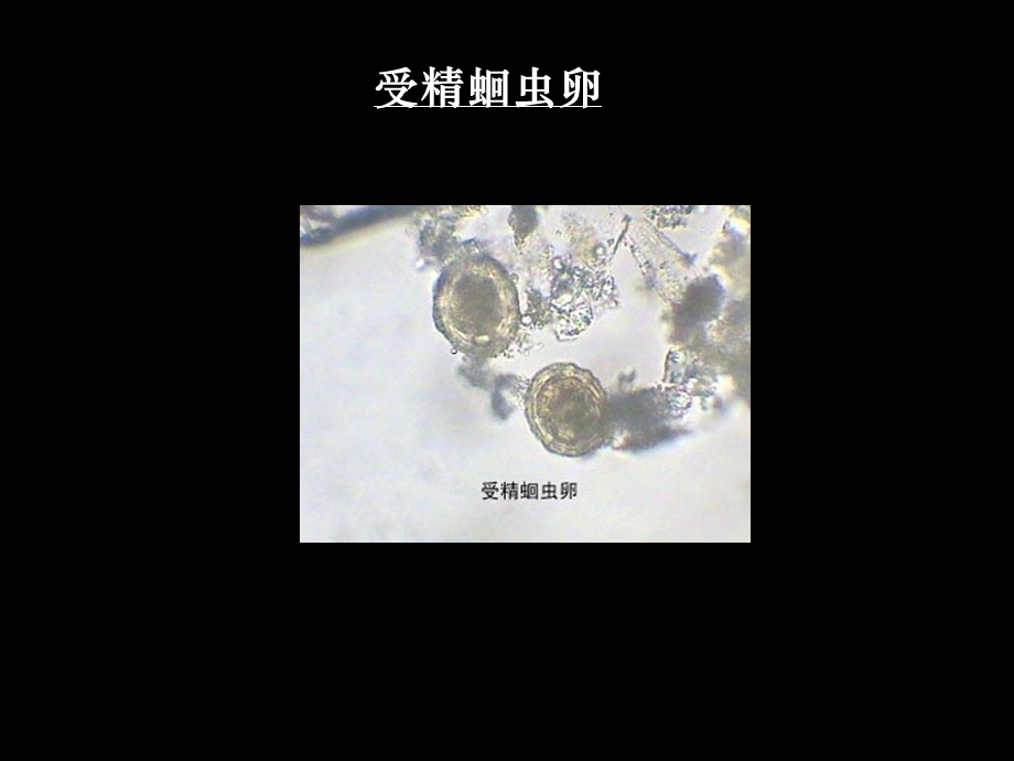 人体寄生虫标本考试.ppt_第1页