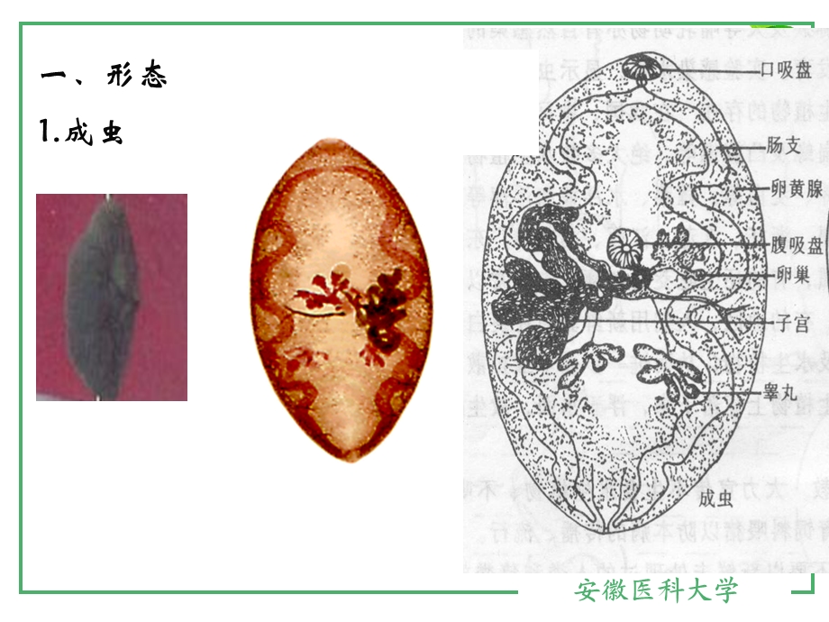 220肺吸虫.ppt_第3页