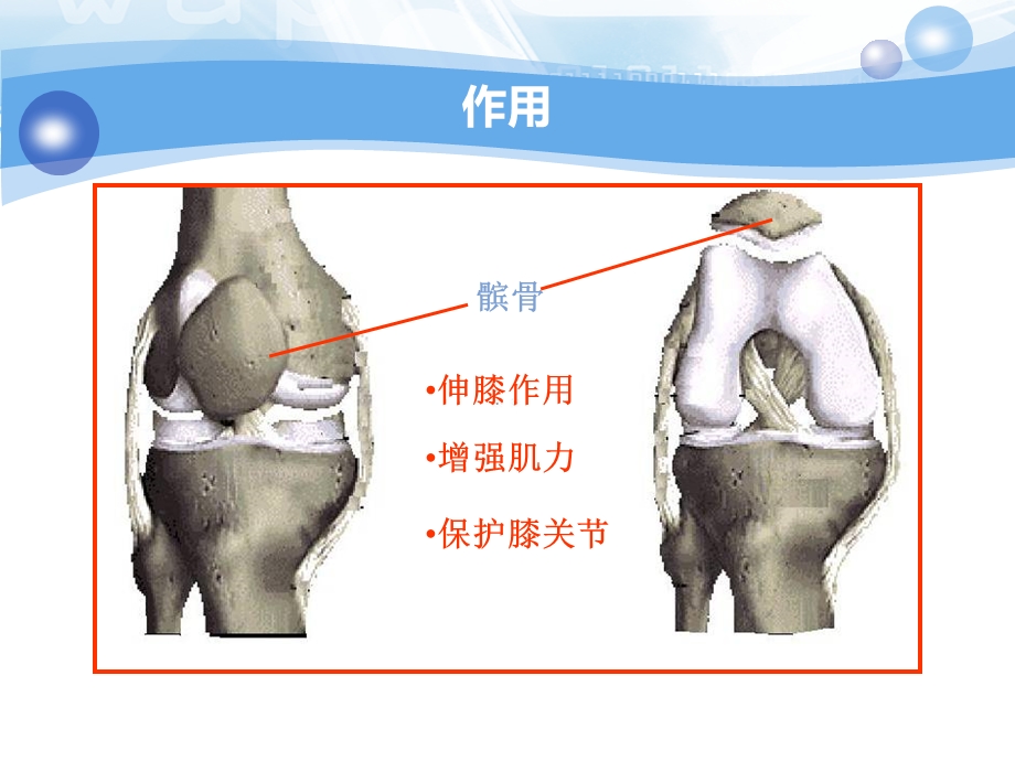 髌骨骨折护理查房.ppt_第3页