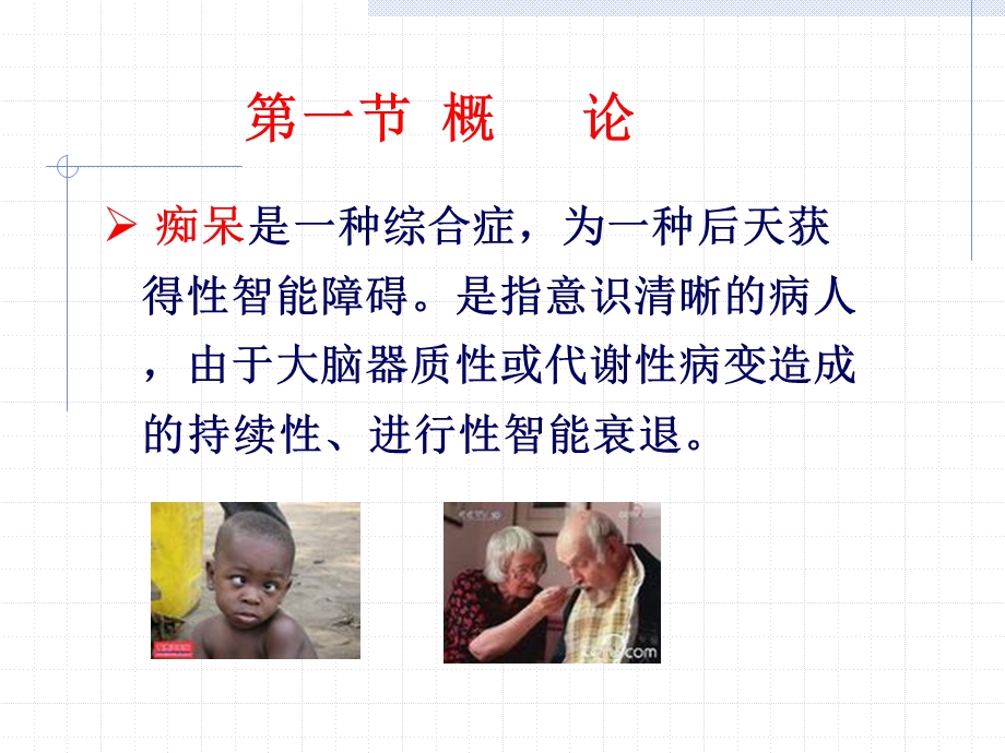 抗老年痴呆药精讲课件.ppt_第3页