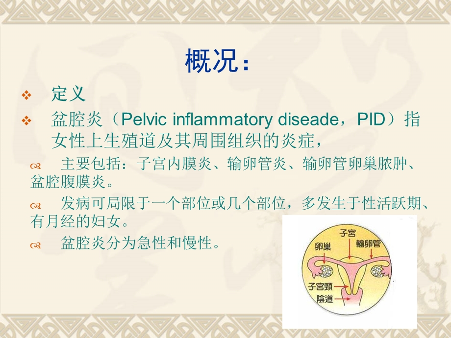 盆腔炎课件.ppt_第2页