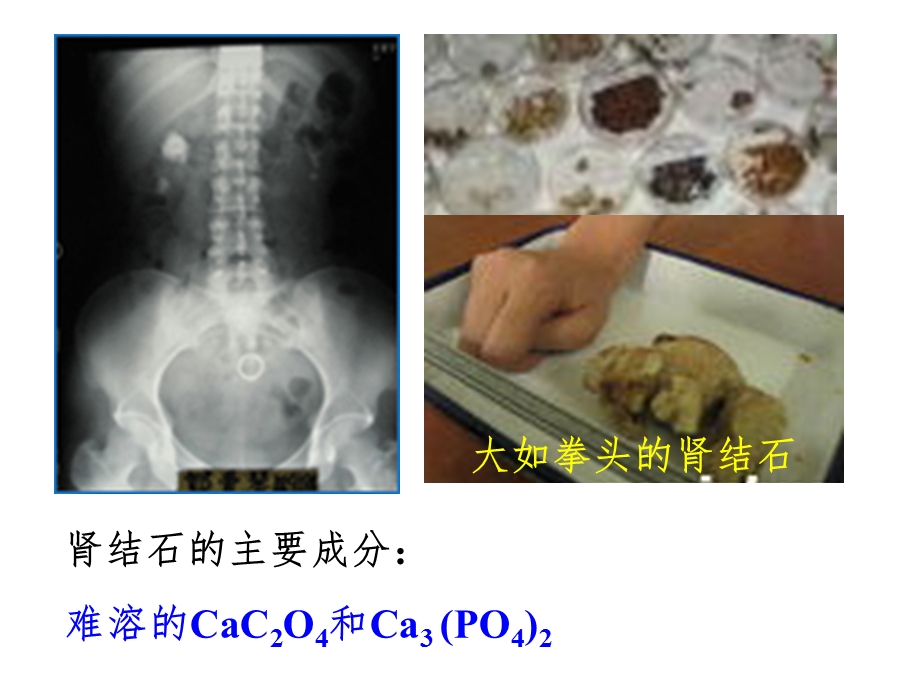 沉淀溶解平衡教学设计课件.ppt_第1页