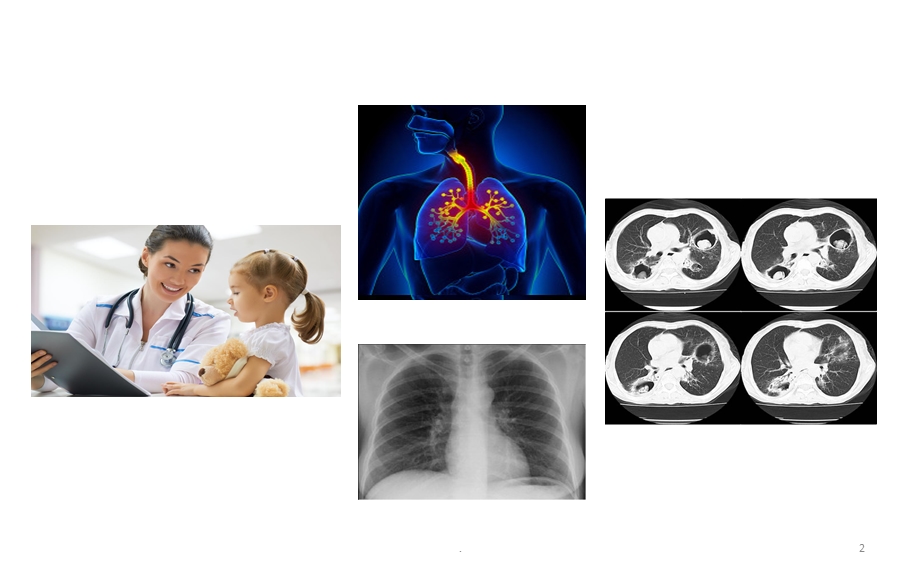 ICU肺部超声基础课件.pptx_第2页
