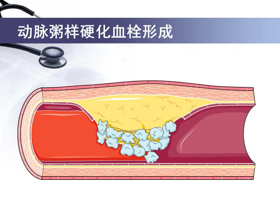 心血管健康教育.ppt_第3页