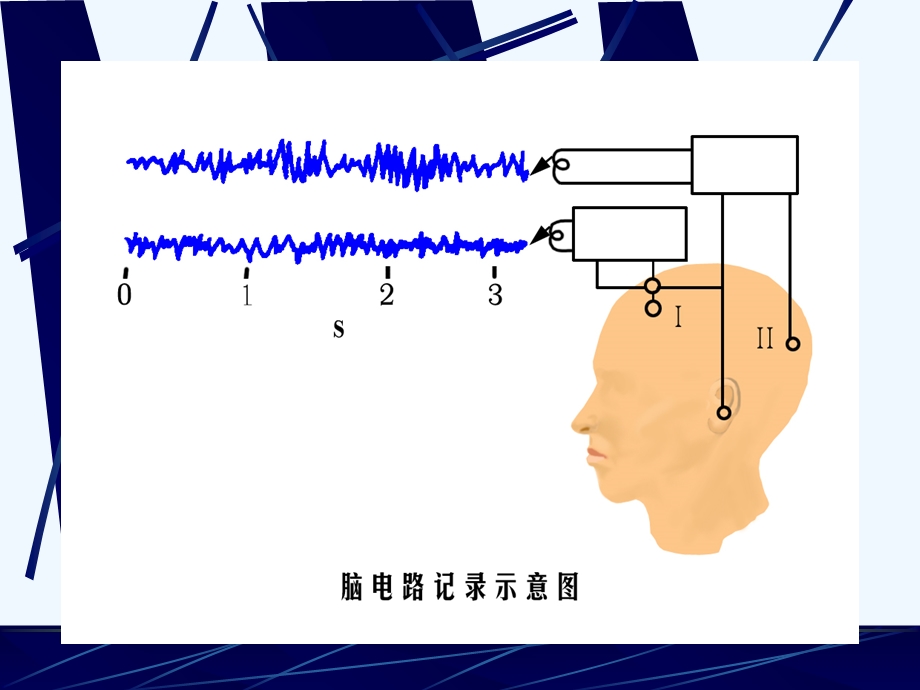 第6-7节觉醒睡眠与脑电活动和高级功能课件.ppt_第3页