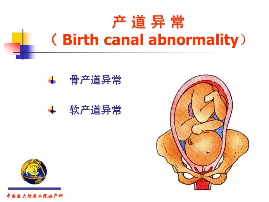 产道异常和产后出血——妇产科学ppt课件.ppt_第3页