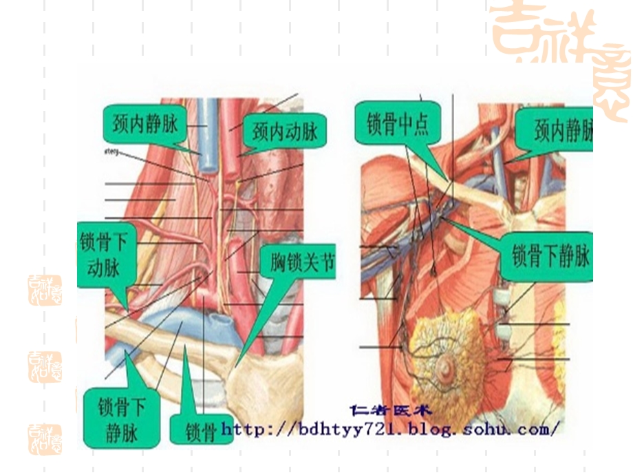 降低中心静脉穿刺（外三）课件.ppt_第3页