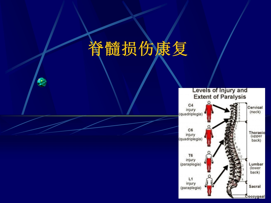 脊髓损伤康复 ppt课件.ppt_第1页