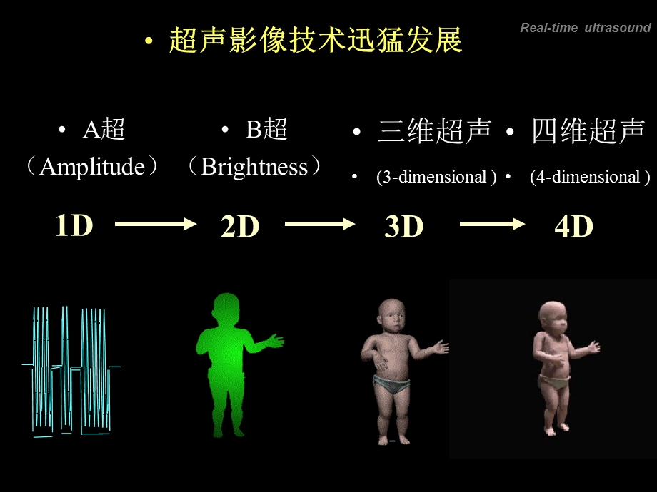 超声（总论、心脏、腹部）临本课件.ppt_第3页