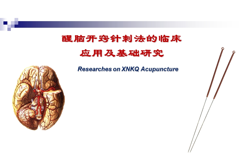 醒脑开窍针刺法的临床应用及基础研究课件.ppt_第1页