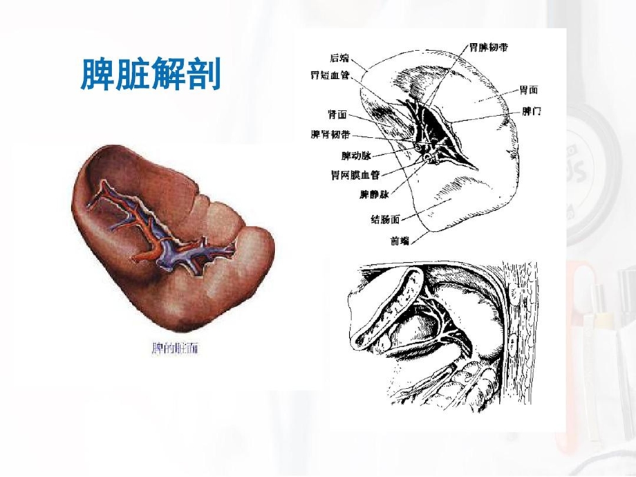 腹腔镜脾切除技巧探讨课件.ppt_第2页