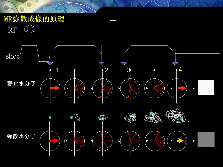 磁共振弥散加权成像原理及应用课件.ppt_第3页