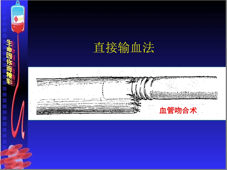 输血严重危害shotppt课件.ppt_第3页