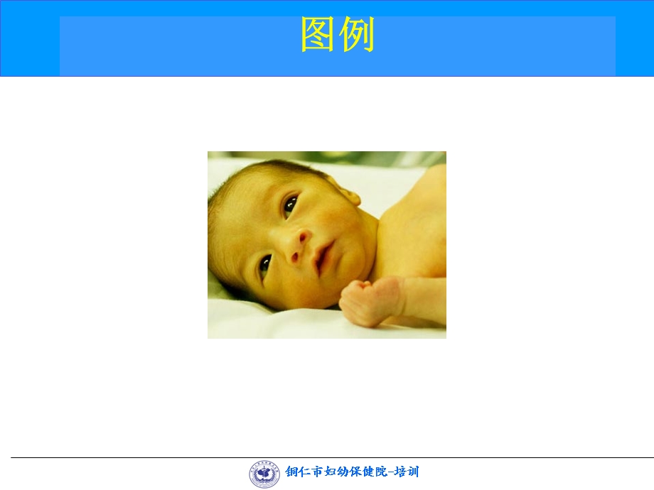 母子健康综合项目培训新生儿黄疸 课件.ppt_第1页