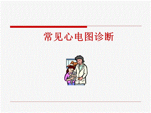 常见心电图诊断.ppt