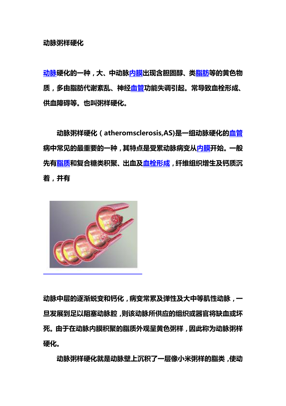 动脉粥样硬化.doc_第1页