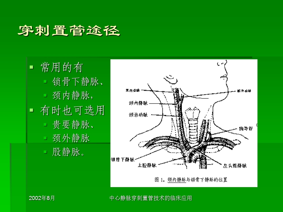 中心静脉穿刺置管技术的临床应用文档资料.ppt_第2页