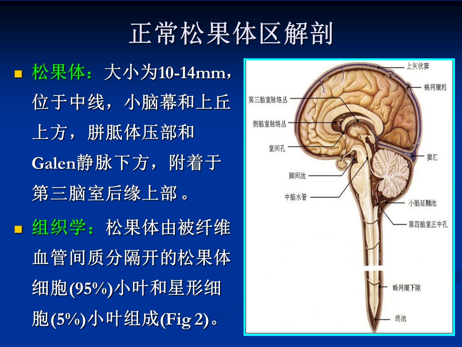 最新松果体区肿瘤PPT文档.ppt_第1页