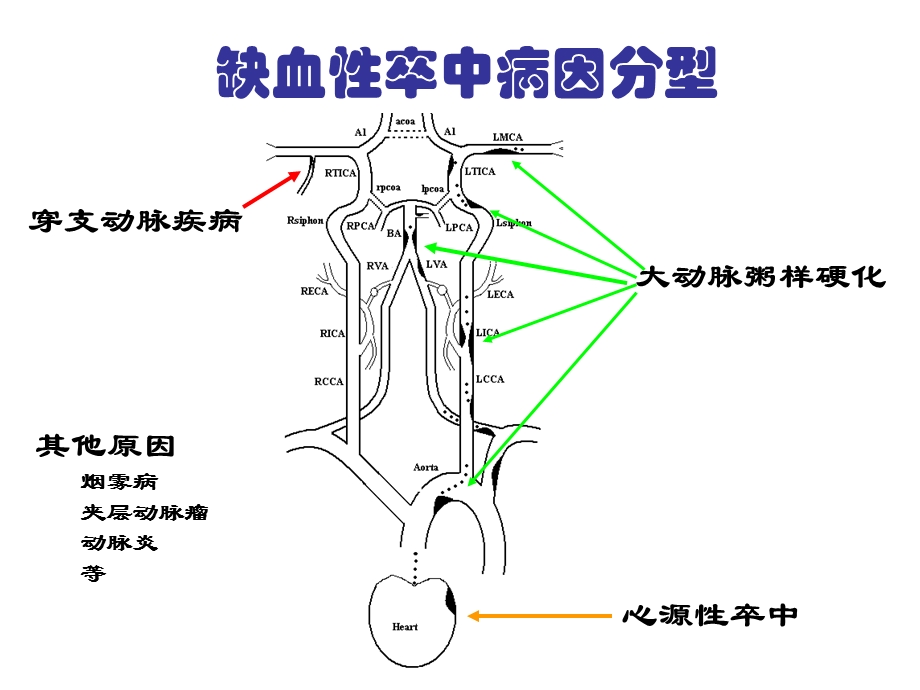 动脉粥样硬化性梗死分层病例文档资料.ppt_第1页