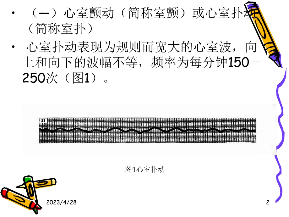 心脏电复律电击PPT文档.ppt_第2页