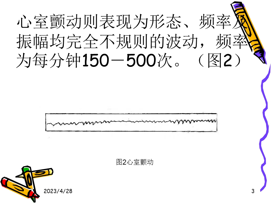 心脏电复律电击PPT文档.ppt_第3页