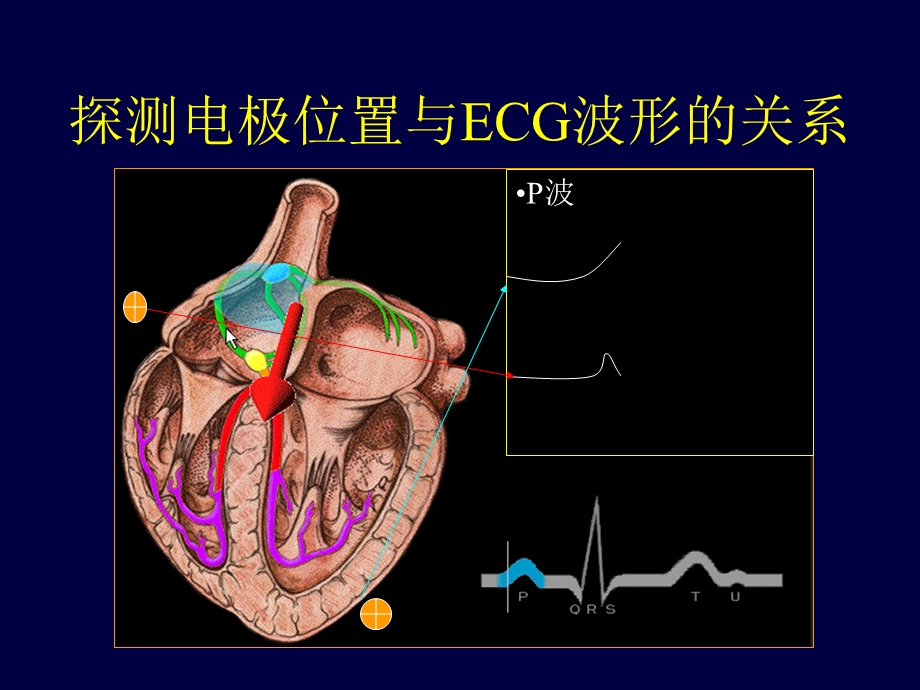 心电图学 课件PPT文档.ppt_第2页