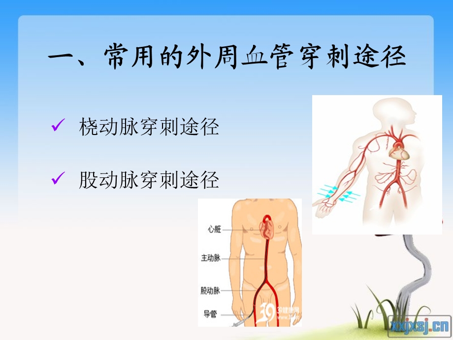 冠脉介入术后护理要点文档资料.ppt_第1页