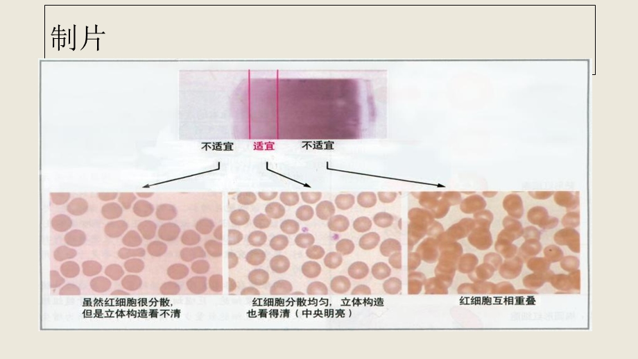 外周血细胞形态文档资料.ppt_第2页