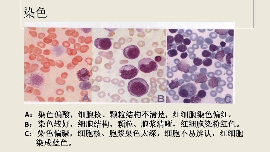 外周血细胞形态文档资料.ppt_第3页