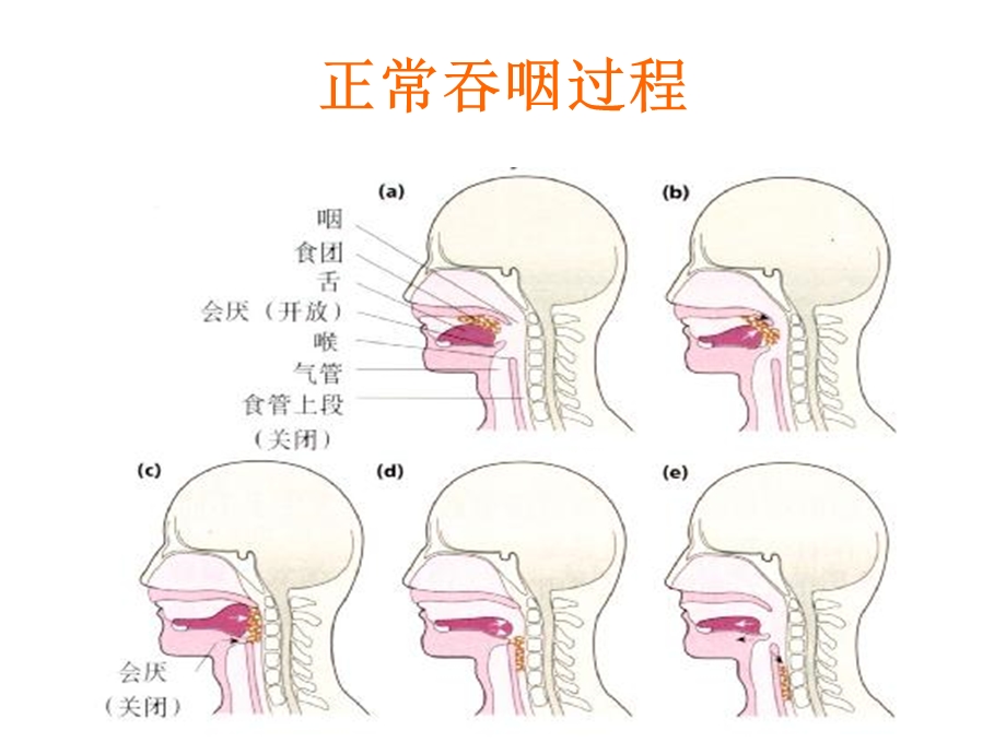 最新吞咽障碍护理.pptPPT文档.ppt_第1页